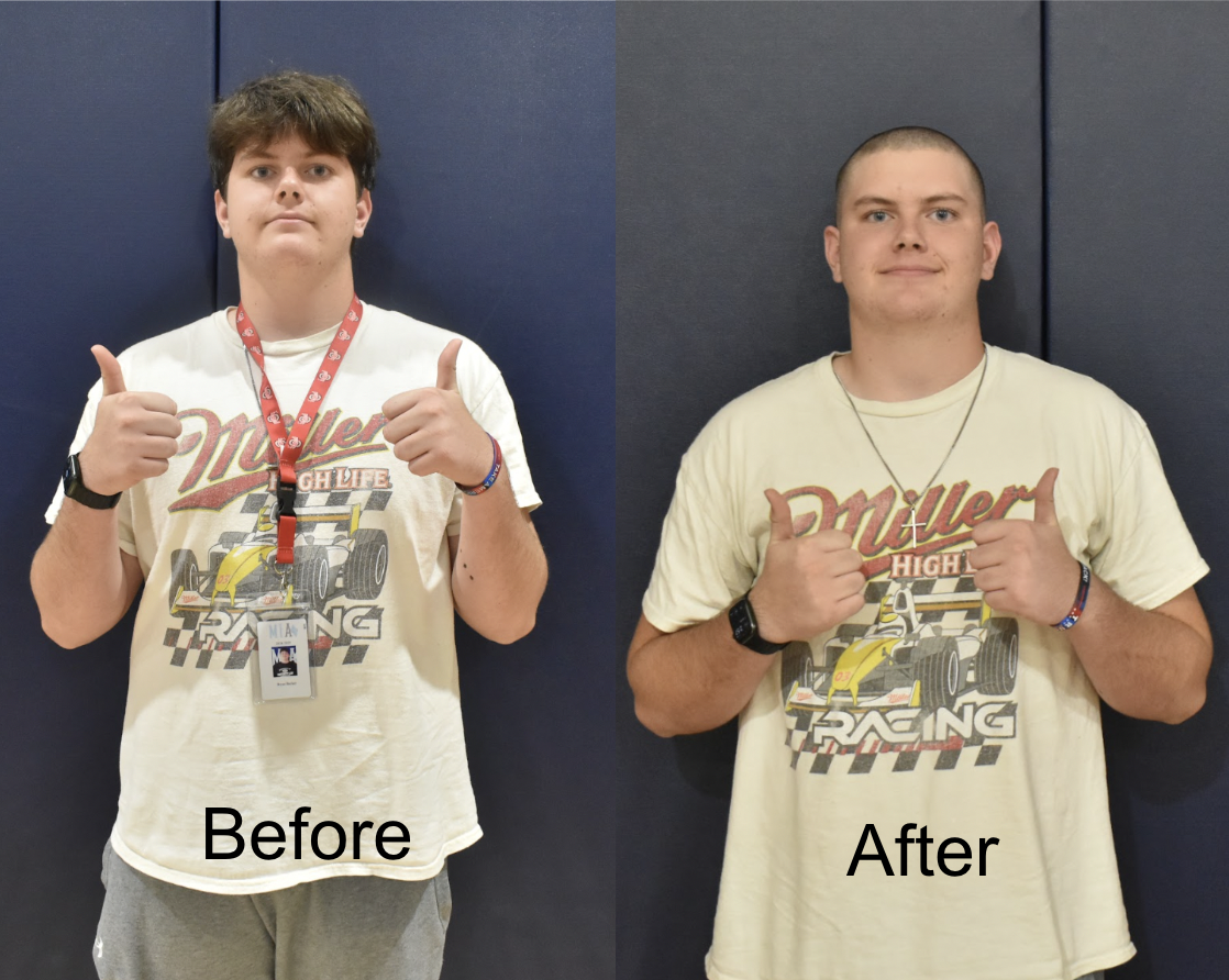 Bryce Becker before and after he shaved his head for the St. Baldrick's Foundation.