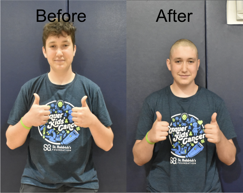 Logan Terreri before and after he shaved his head for the St. Baldrick's Foundation.